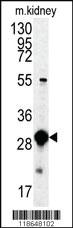 Anti-MPST Rabbit Polyclonal Antibody