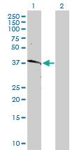 Anti-HLAB Rabbit Polyclonal Antibody