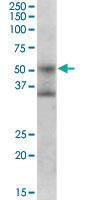 Anti-FOXA1 Goat Polyclonal Antibody