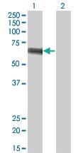 Anti-SLC5A2 Mouse Monoclonal Antibody [clone: 3G8]