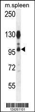 Anti-ACAP1 Rabbit Polyclonal Antibody (AP (Alkaline Phosphatase))