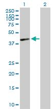 Anti-HLA C Mouse Polyclonal Antibody