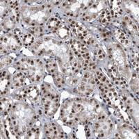 Anti-ZNF518B Rabbit Polyclonal Antibody