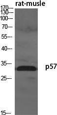 Western blot analysis of various cells using Anti-p57KIP2 Antibody