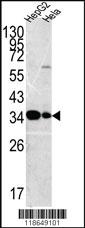 Anti-MPST Rabbit Polyclonal Antibody