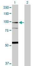 Anti-F13A1 Rabbit Polyclonal Antibody