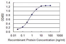 Anti-SLC5A2 Mouse Monoclonal Antibody [clone: 3G8]