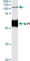 Anti-NOD2 Rabbit Polyclonal Antibody