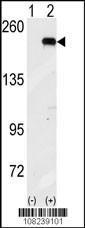 Anti-EIF2AK4 Rabbit Polyclonal Antibody (PE (Phycoerythrin))