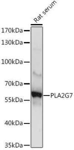 Western blot analysis of extracts of Rat serum, using Anti-PLA2G7 Antibody (A10799) at 1:1,000 dilution The secondary antibody was Goat Anti-Rabbit IgG H&L Antibody (HRP) at 1:10,000 dilution Lysates/proteins were present at 25 µg per lane