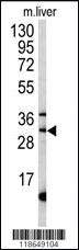 Anti-MPST Rabbit Polyclonal Antibody