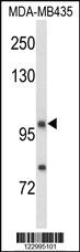 Anti-NRP1 Rabbit Polyclonal Antibody