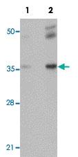 Anti-RHBDD2 Rabbit Polyclonal Antibody