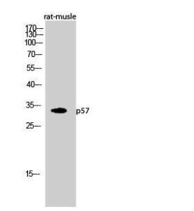 Western blot analysis of rat musle cells using Anti-p57KIP2 Antibody