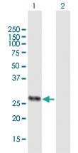 Anti-HLA-DMA Mouse Polyclonal Antibody