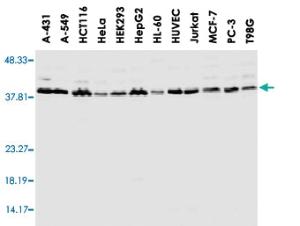 Anti-AHSA1 Rabbit Polyclonal Antibody