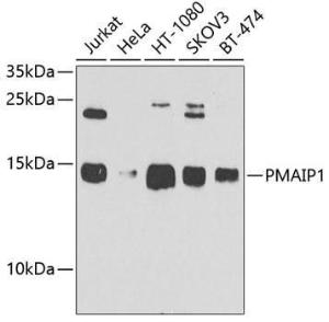 Western blot analysis of extracts of various cell lines, using Anti-Noxa Antibody (A10802) at 1:1,000 dilution