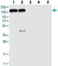 Anti-FAM120A Rabbit Polyclonal Antibody