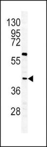 Anti-GHRHR Rabbit polyclonal antibody