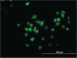 Anti-TFAP4 Mouse Monoclonal Antibody [clone: 7C5]