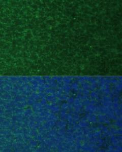 Immunofluorescence analysis of rat thymus cells using Anti-Noxa Antibody (A10802) at a dilution of 1:100. DAPI was used to stain the cell nuclei (blue)