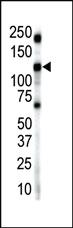 Anti-INSR Rabbit Polyclonal Antibody