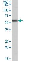 Anti-FOXC1 Goat Polyclonal Antibody