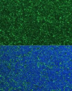 Immunofluorescence analysis of mouse thymus cells using Anti-Noxa Antibody (A10802) at a dilution of 1:100. DAPI was used to stain the cell nuclei (blue)