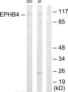 Antibody anti-EPHB4 100 µg