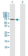 Anti-PIAS2 Rabbit Polyclonal Antibody