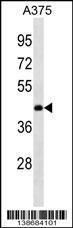 Anti-ANKRD63 Rabbit Polyclonal Antibody (AP (Alkaline Phosphatase))