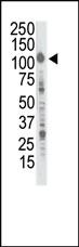 Anti-INSR Rabbit Polyclonal Antibody