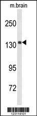 Anti-UTY Rabbit Polyclonal Antibody