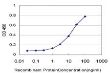 Anti-F13A1 Mouse Monoclonal Antibody [clone: M1]