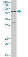 Anti-PIAS2 Rabbit Polyclonal Antibody