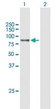 Anti-RP5-1022P6.2 Mouse Polyclonal Antibody