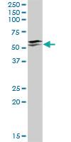 Anti-IRX3 Rabbit Polyclonal Antibody