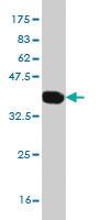 Anti-SLC22A13 Mouse Monoclonal Antibody [clone: 1E6]