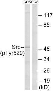 Western blot analysis of lysates from COS7 cells treated with PMA 125ng/ml 30' using Anti-Src (phospho Tyr529) Antibody. The right hand lane represents a negative control, where the antibody is blocked by the immunising peptide