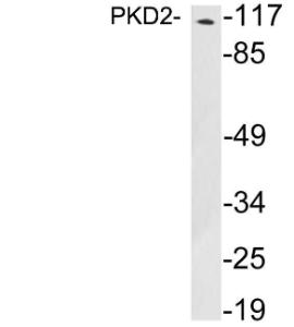 Western blot analysis of lysates from NIH/3T3 cells using Anti-PKD2 Antibody