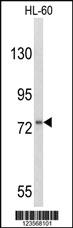 Anti-CSF3R Rabbit Polyclonal Antibody