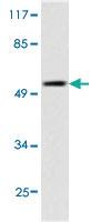 Anti-TP53 Rabbit Polyclonal Antibody