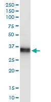 Anti-SCML1 Polyclonal Antibody Pair