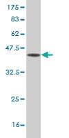 Anti-FABP4 Mouse Monoclonal Antibody [clone: 2H3-1G10]