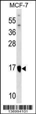 Anti-ITGB1BP1 Rabbit Polyclonal Antibody (FITC (Fluorescein Isothiocyanate))