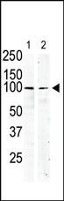 Anti-KIT Rabbit Polyclonal Antibody