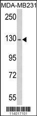 Anti-RASGRF1 Rabbit Polyclonal Antibody (PE (Phycoerythrin))