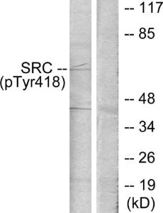 Western blot analysis of lysates from COLO205 cells treated with serum 15% 10' using Anti-Src (phospho Tyr418) Antibody. The right hand lane represents a negative control, where the antibody is blocked by the immunising peptide