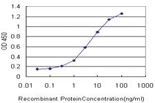 Anti-SLC6A4 Mouse Monoclonal Antibody [clone: 2A9]