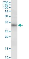 Anti-GIMAP5 Mouse Polyclonal Antibody